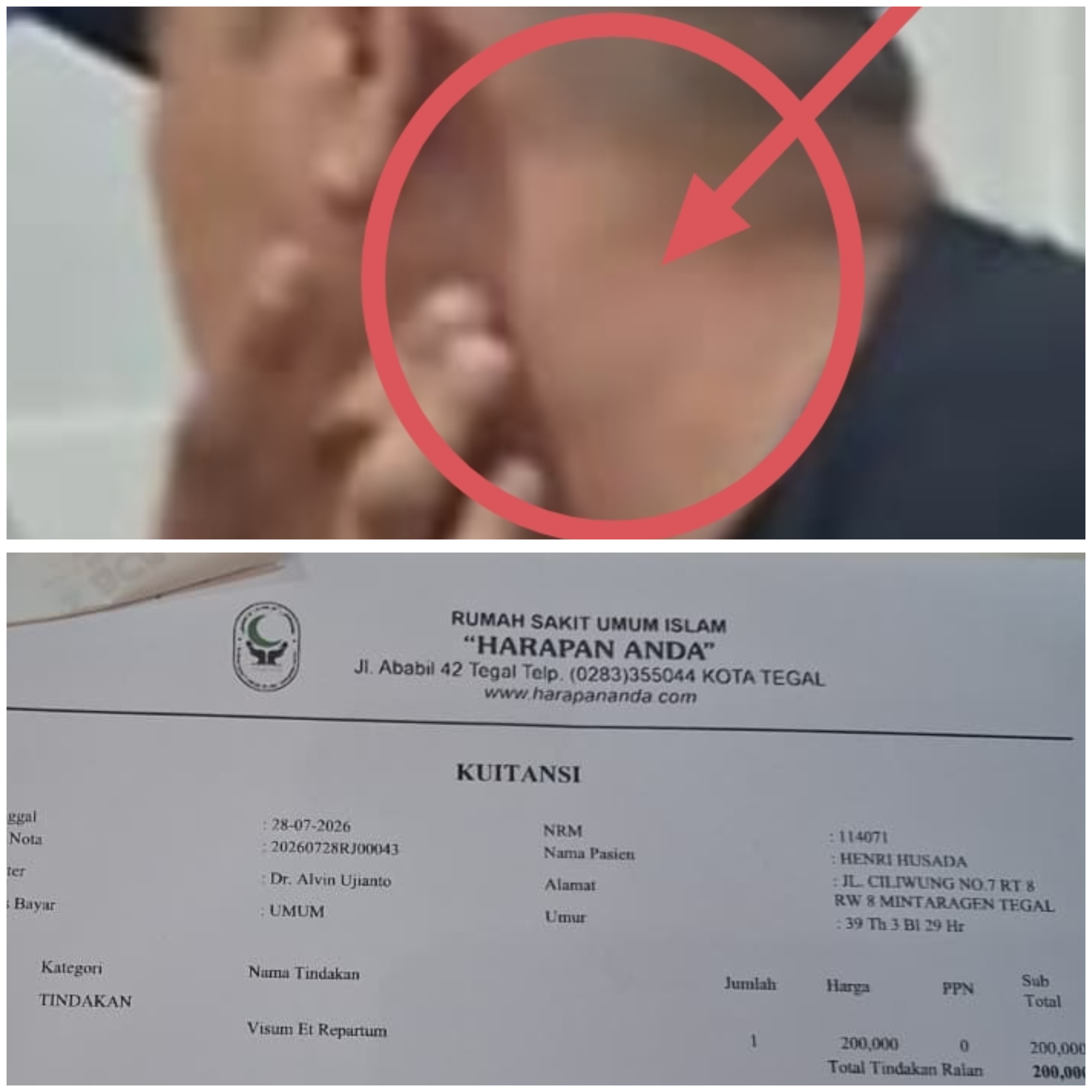 Dugaan Kuat Andi Haryanto Pukul Wartawan MeteorNews Berakhir Damai